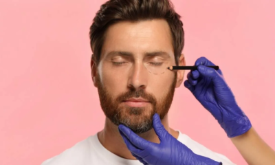 blefaroplastia hombres